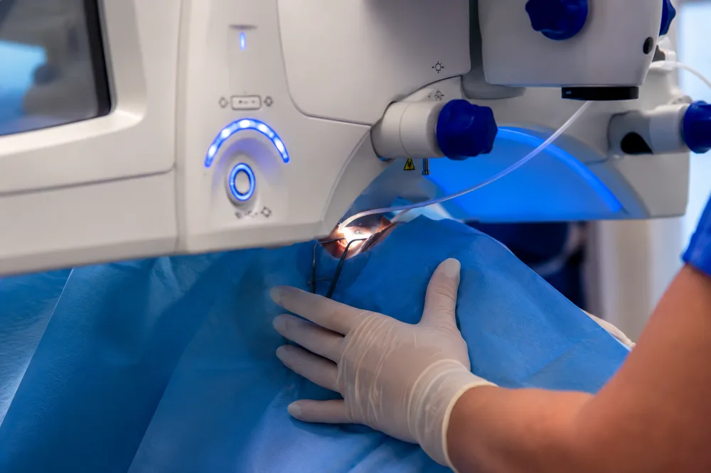 Corecția laser SMILE Pro în sala de operație